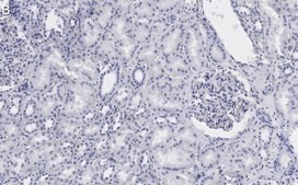 Anti-53BP1 Antibody, clone 1H16 ZooMAb® Rabbit Monoclonal recombinant, expressed in HEK 293 cells