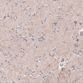 Monoclonal Anti-P2RX7 antibody produced in mouse Prestige Antibodies® Powered by Atlas Antibodies, clone CL11508, purified antibody (Protein A)