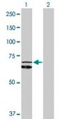 Anti-HSPD1 antibody produced in rabbit purified immunoglobulin, buffered aqueous solution