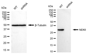 KD-Validated Anti NIMA Related Kinase 6 Antibody, clone 24GB755, Rabbit Monoclonal clone 24GB755, recombinant rabbit monoclonal, expressed in HEK293 cells