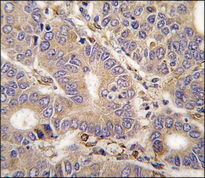Anti-CARS2 (C-term) antibody produced in rabbit saturated ammonium sulfate (SAS) precipitated, buffered aqueous solution
