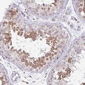 Anti-ADAT3 antibody produced in rabbit Prestige Antibodies&#174; Powered by Atlas Antibodies, affinity isolated antibody, buffered aqueous glycerol solution