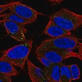 Anti-TVP23A antibody produced in rabbit Prestige Antibodies&#174; Powered by Atlas Antibodies, affinity isolated antibody, buffered aqueous glycerol solution
