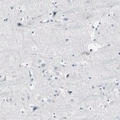 抗-COL6A3 兔抗 Prestige Antibodies&#174; Powered by Atlas Antibodies, affinity isolated antibody, buffered aqueous glycerol solution
