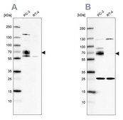 Anti-CCDC86 antibody produced in rabbit Prestige Antibodies® Powered by Atlas Antibodies, affinity isolated antibody, buffered aqueous glycerol solution