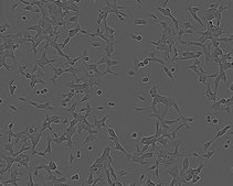 LNCap Clone FGC Cell Line human NOTE: Both the cell line and DNA from the cell line may be available for this product. Please choose -1VL or VIAL for cells, or -DNA-5UG for DNA, 89110211, human prostate (carcinoma), Epithelial-like