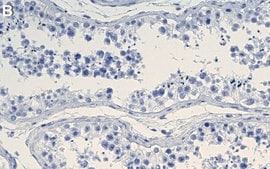 Anti-DEPDC5 Antibody, clone 1G17 ZooMAb&#174; Rabbit Monoclonal recombinant, expressed in HEK 293 cells