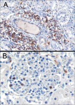 Anti-SH3BP1 antibody produced in goat affinity isolated antibody, buffered aqueous solution