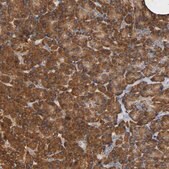 Anti-NDUFS3 antibody produced in rabbit Prestige Antibodies&#174; Powered by Atlas Antibodies, affinity isolated antibody, buffered aqueous glycerol solution