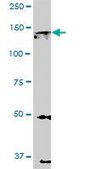 Monoclonal Anti-EPHA2 antibody produced in mouse clone 1E3, purified immunoglobulin, buffered aqueous solution