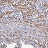 Anti-SMS antibody produced in rabbit Prestige Antibodies&#174; Powered by Atlas Antibodies, affinity isolated antibody, buffered aqueous glycerol solution, ab2