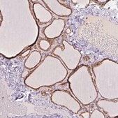 Anti-PRKCSH antibody produced in rabbit Prestige Antibodies&#174; Powered by Atlas Antibodies, affinity isolated antibody, buffered aqueous glycerol solution