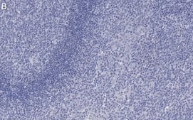 Anti-Cytokeratin 5/6 Antibody, clone D5/16 B4 ZooMAb&#174; Mouse Monoclonal recombinant, expressed in HEK 293 cells