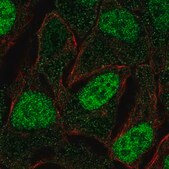 Anti-FAM84A antibody produced in rabbit Prestige Antibodies&#174; Powered by Atlas Antibodies, affinity isolated antibody, buffered aqueous glycerol solution