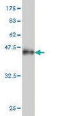 Monoclonal Anti-ANKRA2 antibody produced in mouse clone 1D11, purified immunoglobulin, buffered aqueous solution