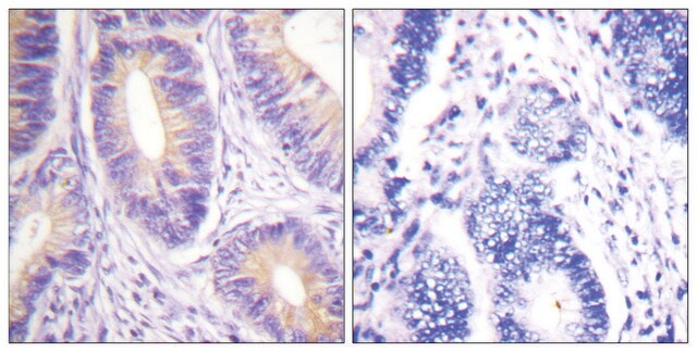 Anti-CBL antibody produced in rabbit affinity isolated antibody