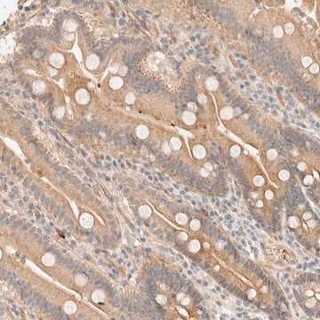 Anti-TNK1 antibody produced in rabbit Prestige Antibodies&#174; Powered by Atlas Antibodies, affinity isolated antibody, buffered aqueous glycerol solution