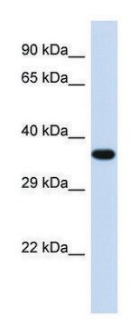 Anti-TOB2 antibody produced in rabbit affinity isolated antibody