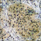 Anti-phospho-HSL (pSer552) antibody produced in rabbit affinity isolated antibody