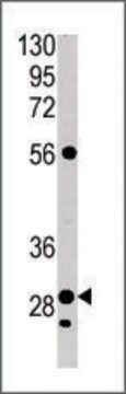 Anti-CA9 (center) antibody produced in rabbit IgG fraction of antiserum, buffered aqueous solution