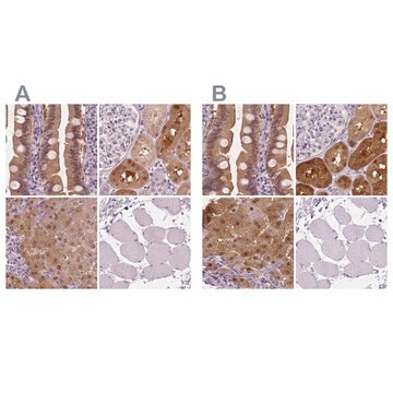 Anti-TKFC antibody produced in rabbit Prestige Antibodies® Powered by Atlas Antibodies, affinity isolated antibody, buffered aqueous glycerol solution