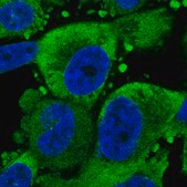 Anti-TRAPPC6B antibody produced in rabbit Prestige Antibodies&#174; Powered by Atlas Antibodies, affinity isolated antibody, buffered aqueous glycerol solution