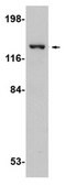 抗-SAPAP4 抗体 from rabbit, purified by affinity chromatography