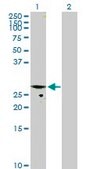 Anti-CMPK antibody produced in mouse purified immunoglobulin, buffered aqueous solution
