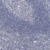 抗-BDH1 兔抗 Prestige Antibodies&#174; Powered by Atlas Antibodies, affinity isolated antibody, buffered aqueous glycerol solution