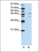 Anti-SMAD2 antibody produced in rabbit IgG fraction of antiserum