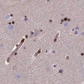 Anti-DNPEP antibody produced in rabbit Prestige Antibodies&#174; Powered by Atlas Antibodies, affinity isolated antibody, buffered aqueous glycerol solution