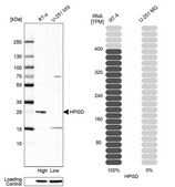 Anti-HPGD antibody produced in rabbit Ab1, Prestige Antibodies&#174; Powered by Atlas Antibodies, affinity isolated antibody, buffered aqueous glycerol solution