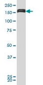 Monoclonal Anti-MLLT10 antibody produced in mouse clone 6H8, purified immunoglobulin, buffered aqueous solution