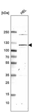 Monoclonal Anti-Pms1 Antibody Produced In Mouse Prestige Antibodies&#174; Powered by Atlas Antibodies, clone CL14436, affinity isolated antibody, buffered aqueous glycerol solution
