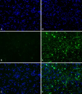 StressMarq Alpha Synuclein Pre-formed Fibrils (Type 2) 100 µg