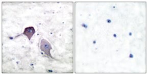Anti-Presenilin 1 antibody produced in rabbit affinity isolated antibody