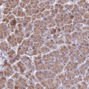 Anti-CCDC85A antibody produced in rabbit Prestige Antibodies&#174; Powered by Atlas Antibodies, affinity isolated antibody, buffered aqueous glycerol solution