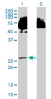 Anti-C14ORF124 antibody produced in mouse purified immunoglobulin, buffered aqueous solution