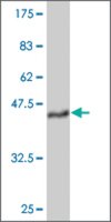 ANTI-TEK antibody produced in mouse clone 4G9, purified immunoglobulin, buffered aqueous solution