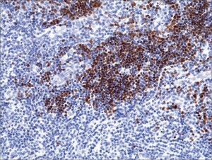 Anti-Terminal deoxynucleotidyl transferase (TdT) antibody, Rabbit monoclonal recombinant, expressed in HEK 293 cells, clone RM379, purified immunoglobulin