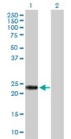Anti-RAB39B antibody produced in rabbit purified immunoglobulin, buffered aqueous solution
