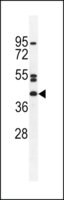 ANTI-NT5DC4 (CENTER) antibody produced in rabbit affinity isolated antibody, buffered aqueous solution