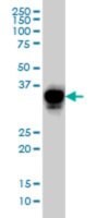 Monoclonal Anti-CRX antibody produced in mouse clone 4G11, purified immunoglobulin, buffered aqueous solution