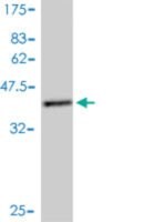Monoclonal Anti-TRAPPC2 antibody produced in mouse clone 2E10, purified immunoglobulin, buffered aqueous solution