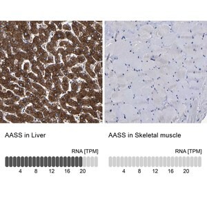 Anti-AASS antibody produced in rabbit Prestige Antibodies&#174; Powered by Atlas Antibodies, affinity isolated antibody, buffered aqueous glycerol solution, Ab3