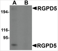 Anti-RGPD5 (ab2) antibody produced in rabbit affinity isolated antibody, buffered aqueous solution