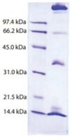 Chylomicrons from human plasma &#8805;95% (SDS-PAGE)