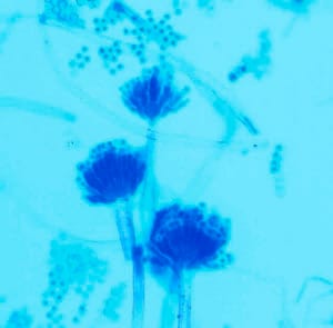 Lactophenol blue solution for staining fungi