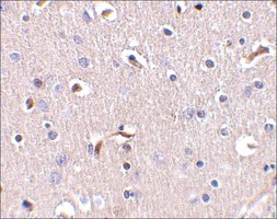 Anti-APH1 (ab2) antibody produced in rabbit affinity isolated antibody, buffered aqueous solution