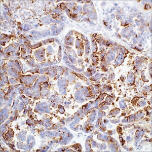 HBME-1 (HBME-1) Mouse Monoclonal Antibody